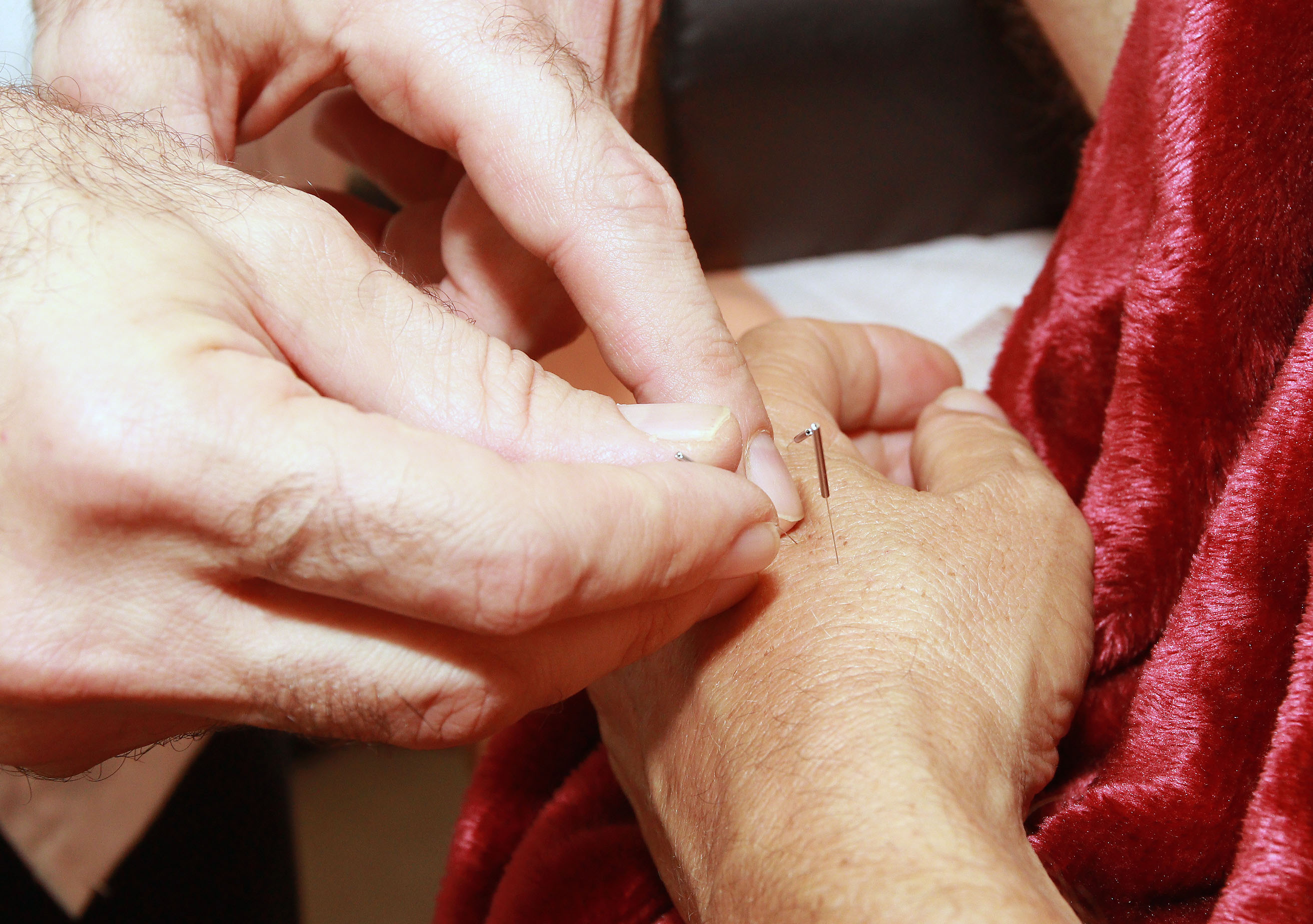 Acupuncture for fertility