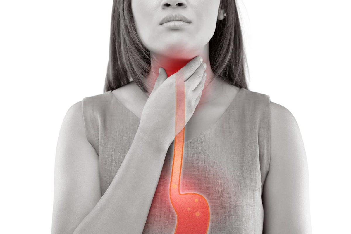 Woman holding her throat with the esophagus highlighted in red — acupuncture for acid reflux and heartburn in Boca Raton by Ronen Rosenblatt Nir