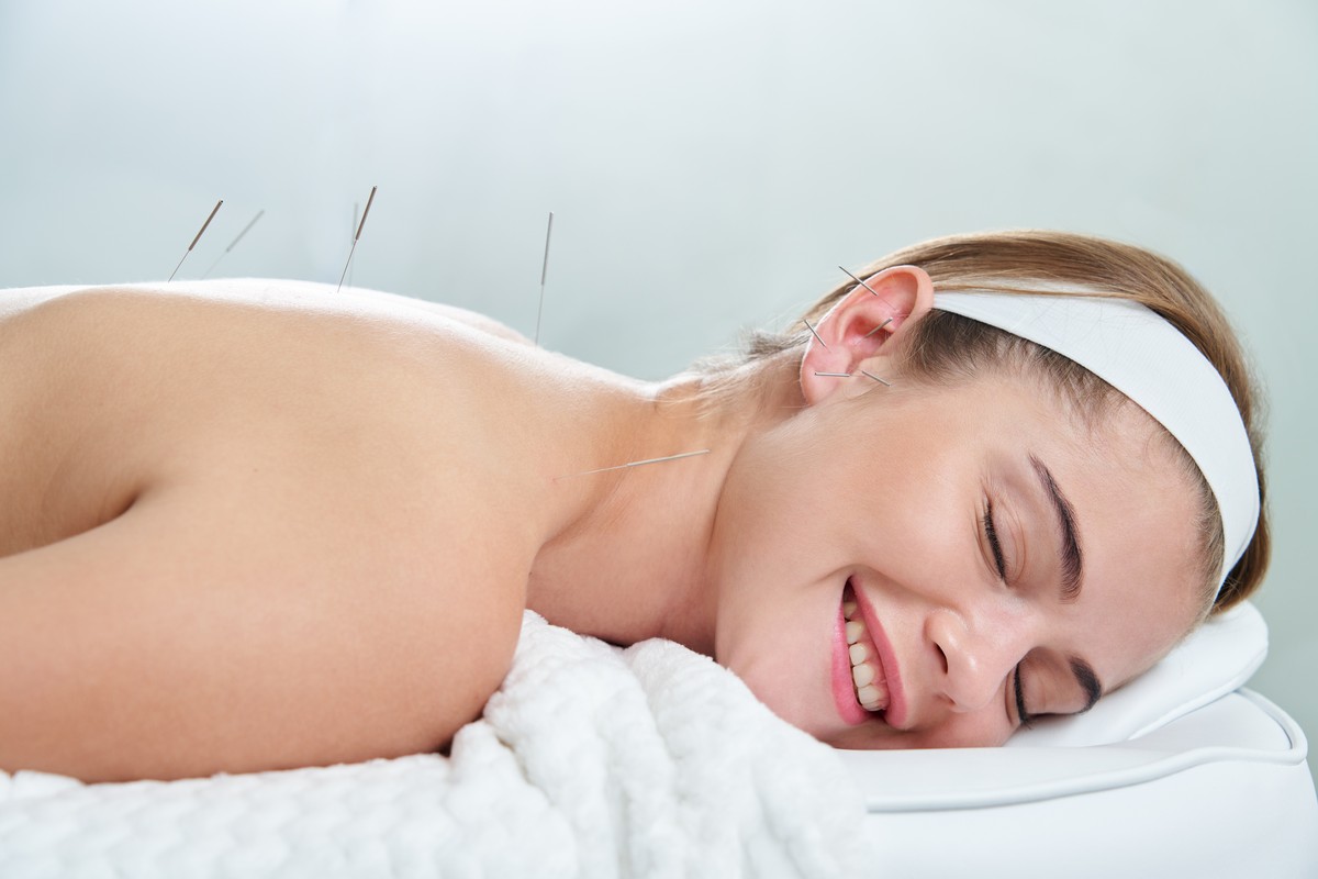 Acupuncture for stress relief in Boca Raton