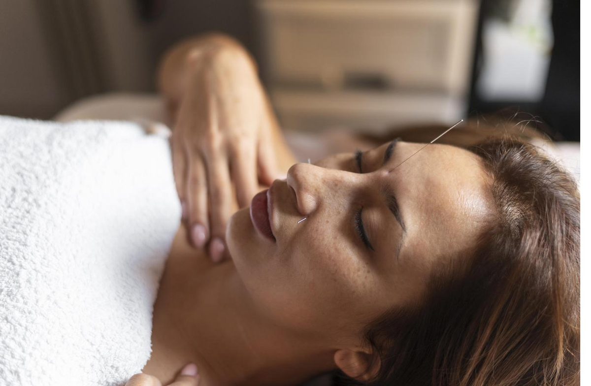 Patient resting calmly during acupuncture treatment for insomnia — Ronen Acupuncture Boca Raton, Ronen Rosenblatt Nir