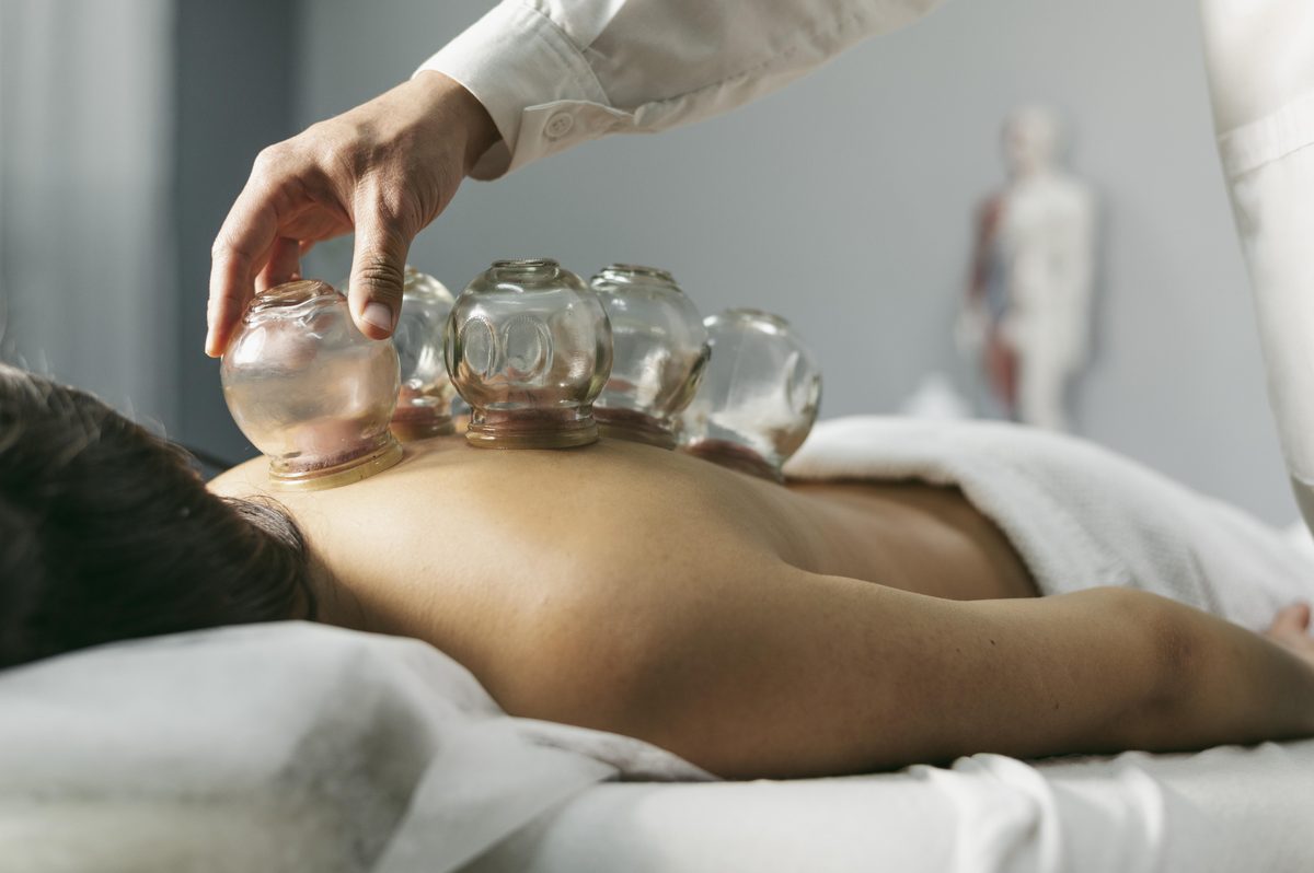 Cupping therapy treatment on back with glass suction cups - Traditional Chinese medicine healing technique