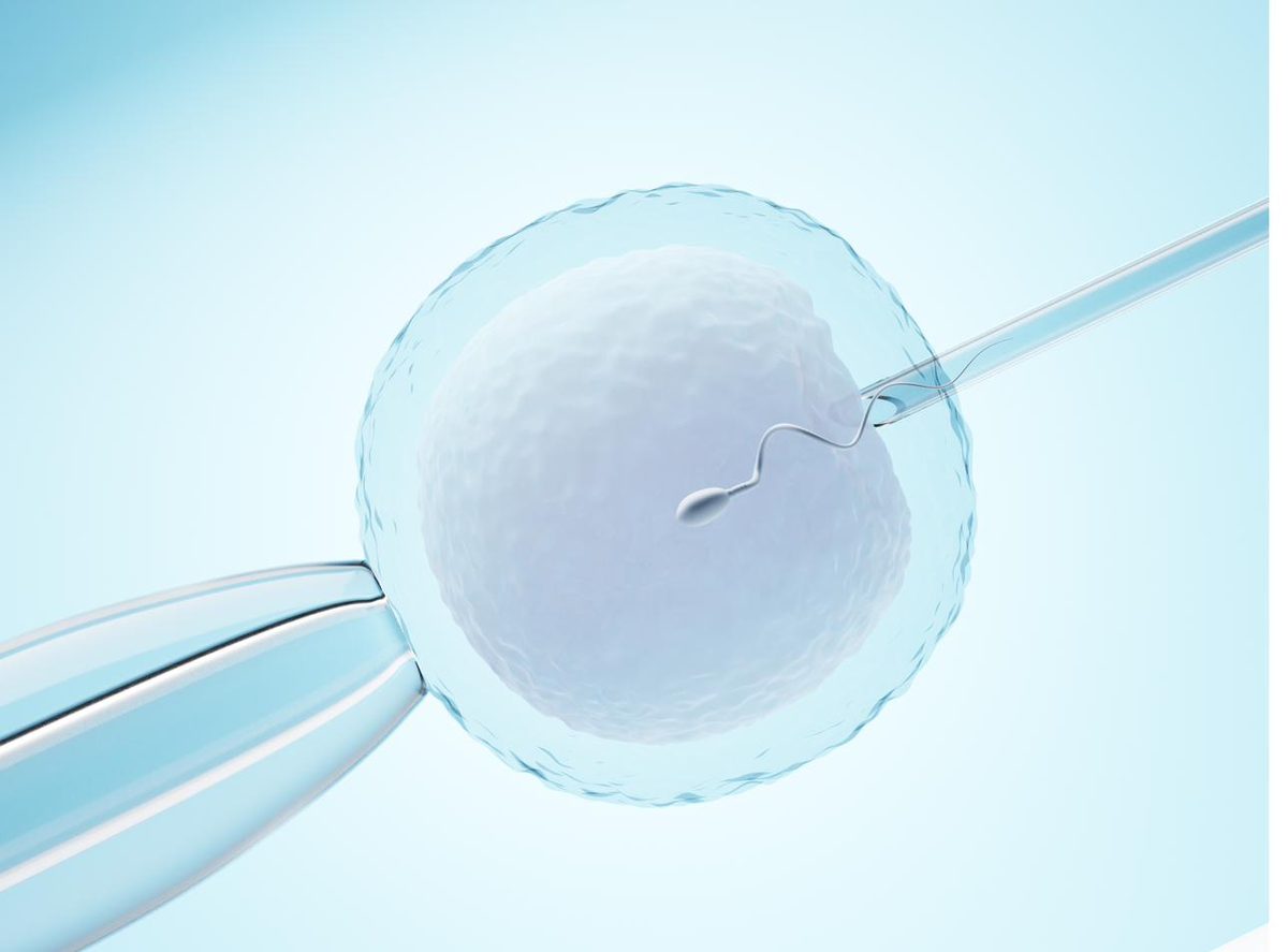 IVF and ICSI fertilization — acupuncture as supportive male fertility care in Boca Raton, Ronen Rosenblatt Nir